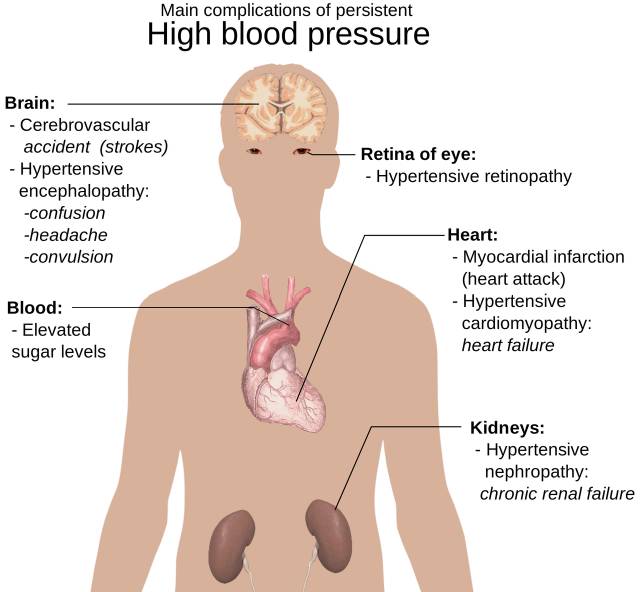 Take time to check your blood pressure